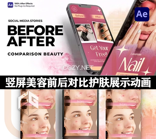 AE模板|社交媒体美容前后对比护肤品牌展示动画 Before After Comparison Beauty
